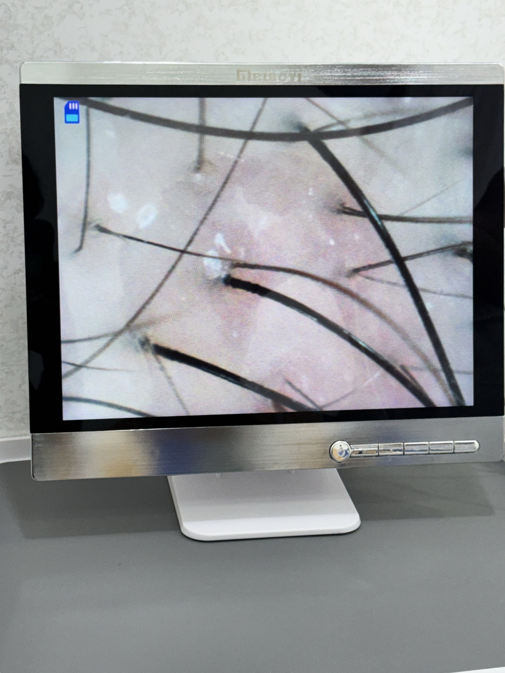 毛囊檢測過程示意