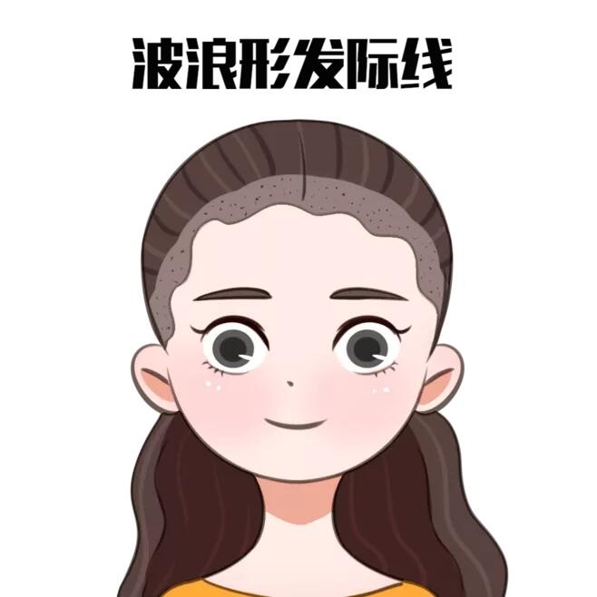 圓形臉適配M形髮際線示意圖