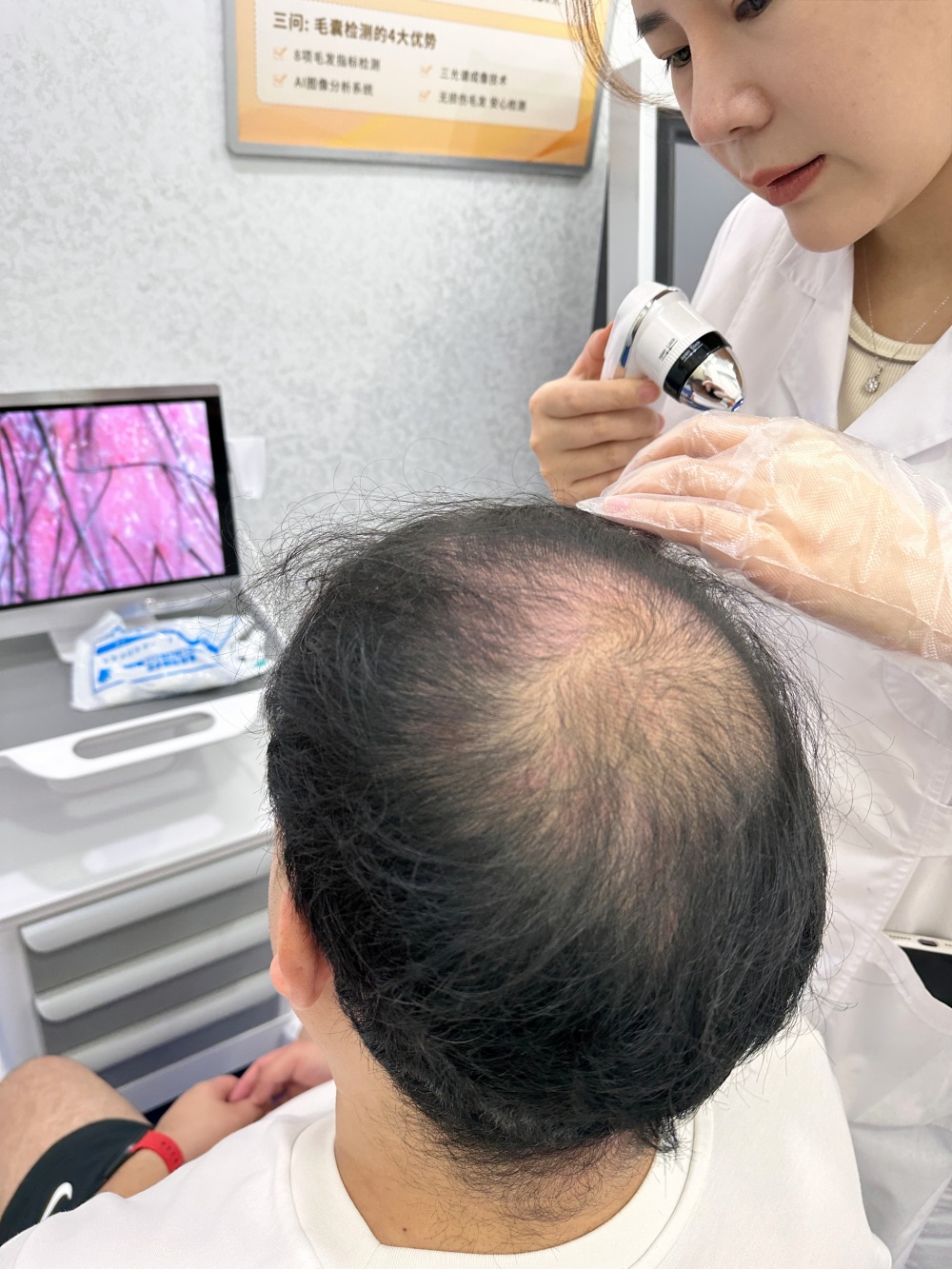 深圳鵬程醫院植髮毛髮檢測毛囊檢測