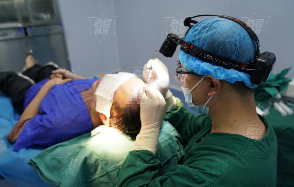 植髮手術過程圖