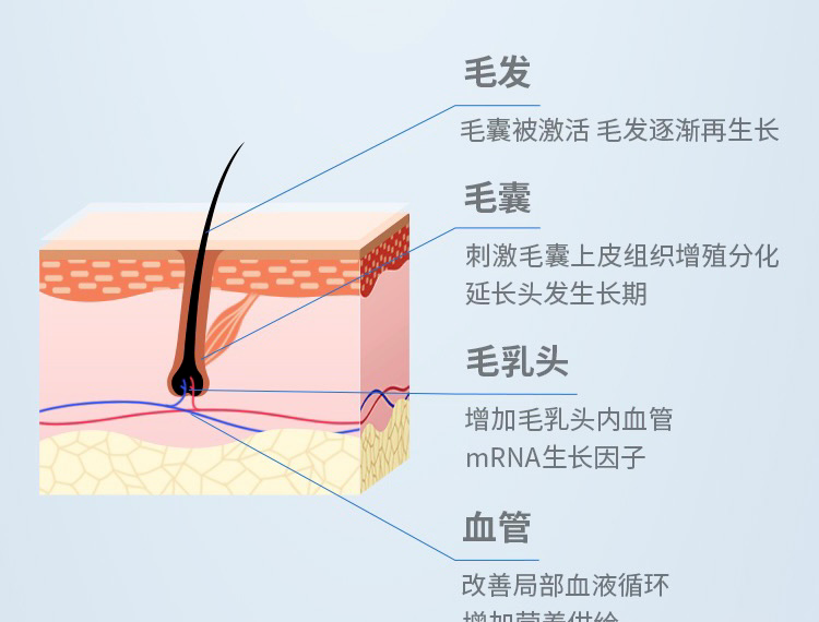 植髮手術示意圖