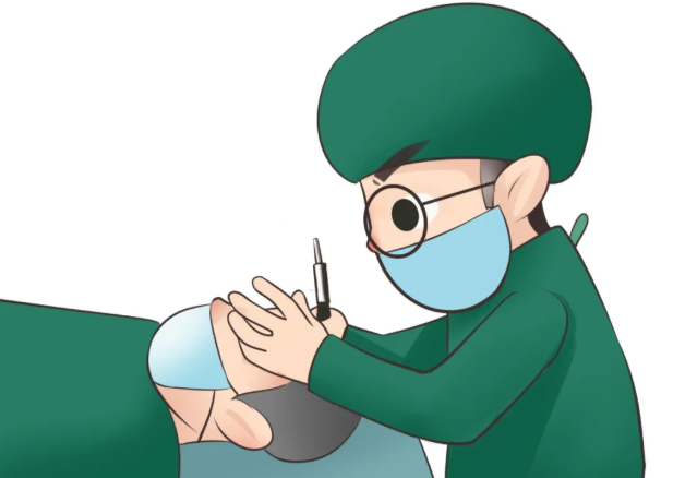 醫生植髮示意圖