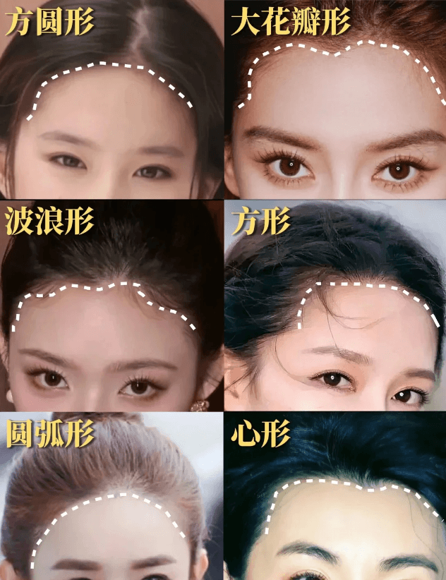常見髮際線形狀