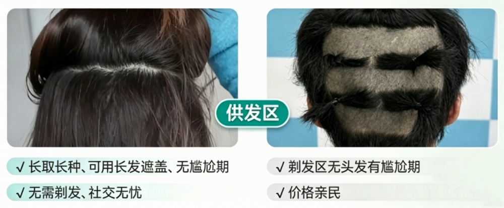 不剃髮為何比剃髮貴幾萬？