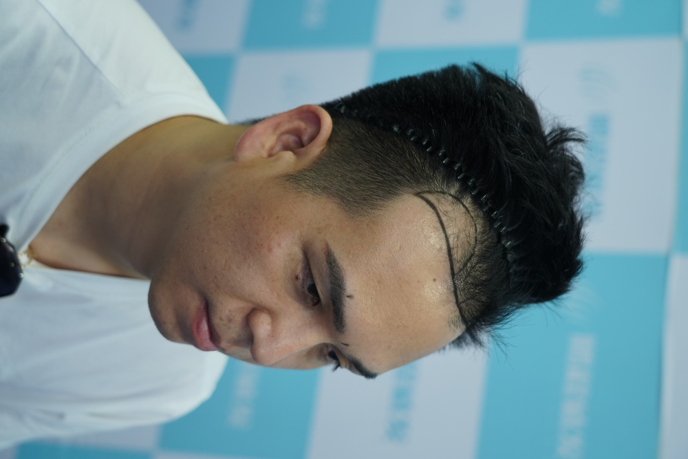 髮際線不斷後移