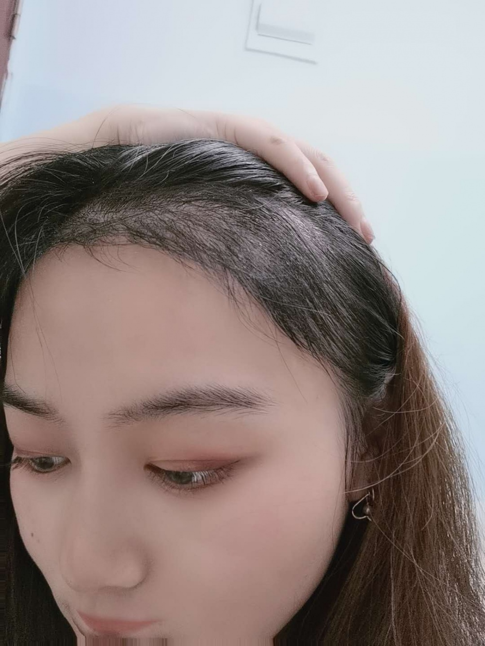 術後3–4個月