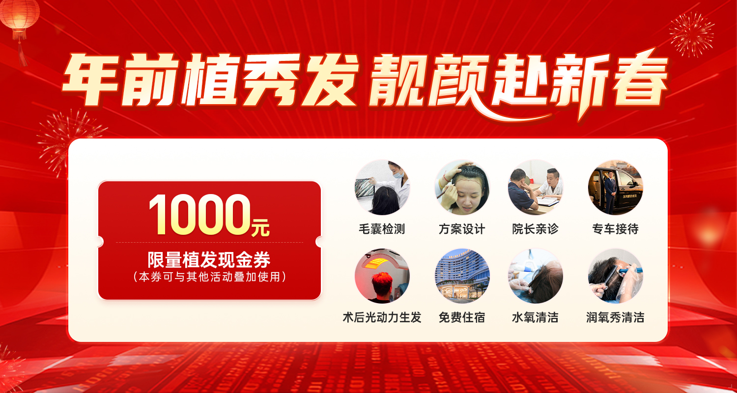 春節植髮前必知事項｜影響手術成功率的關鍵因素大公開