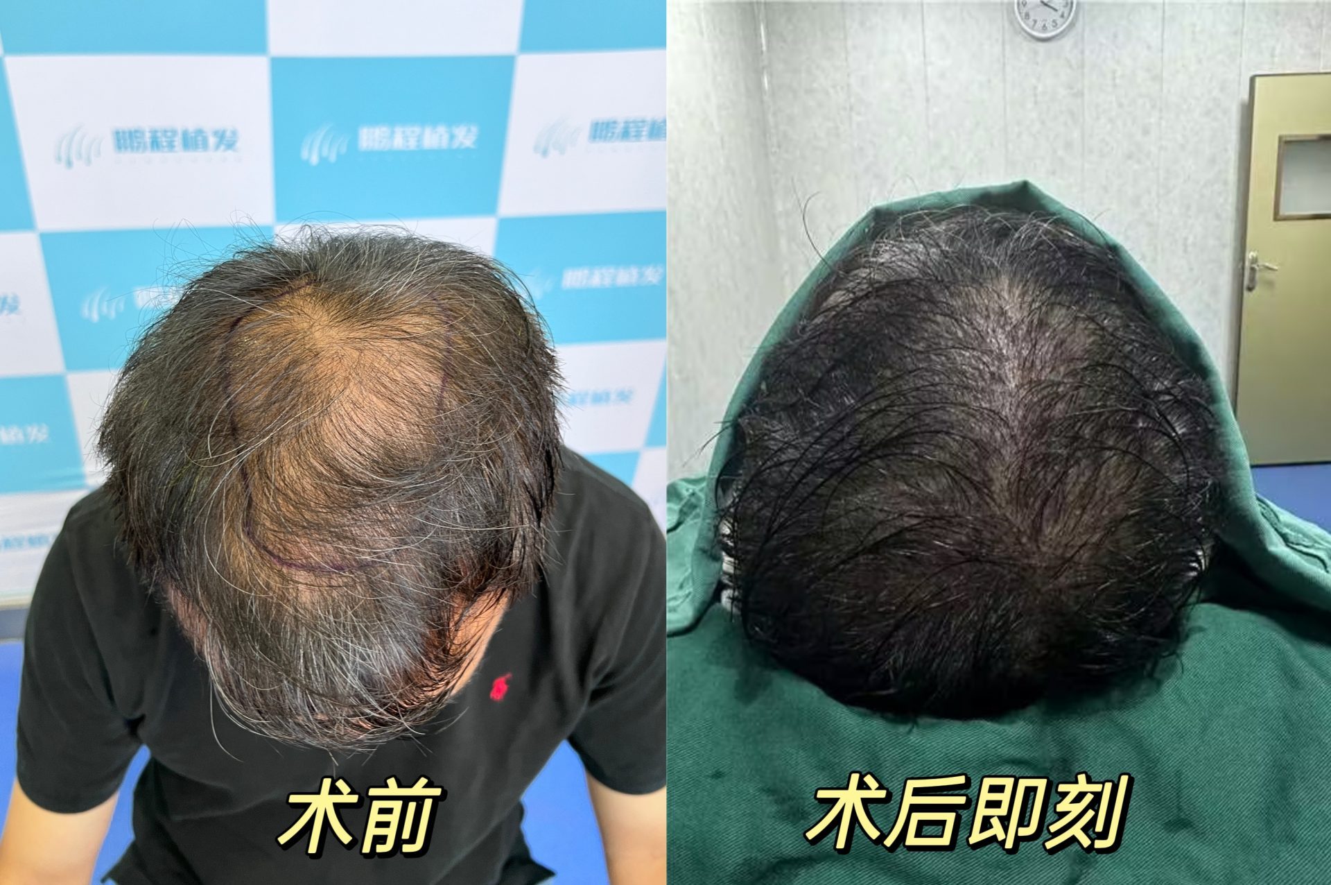 香港人告別雄脫焦慮：從預防到治療，抓住黃金期就贏了