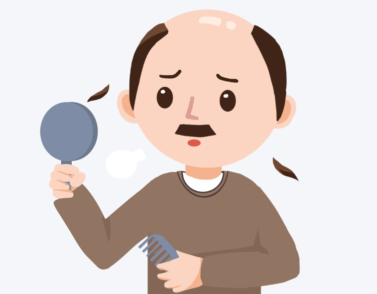 香港男士注意！脫髮點解比女士多？成因 + 改善方法一次講清