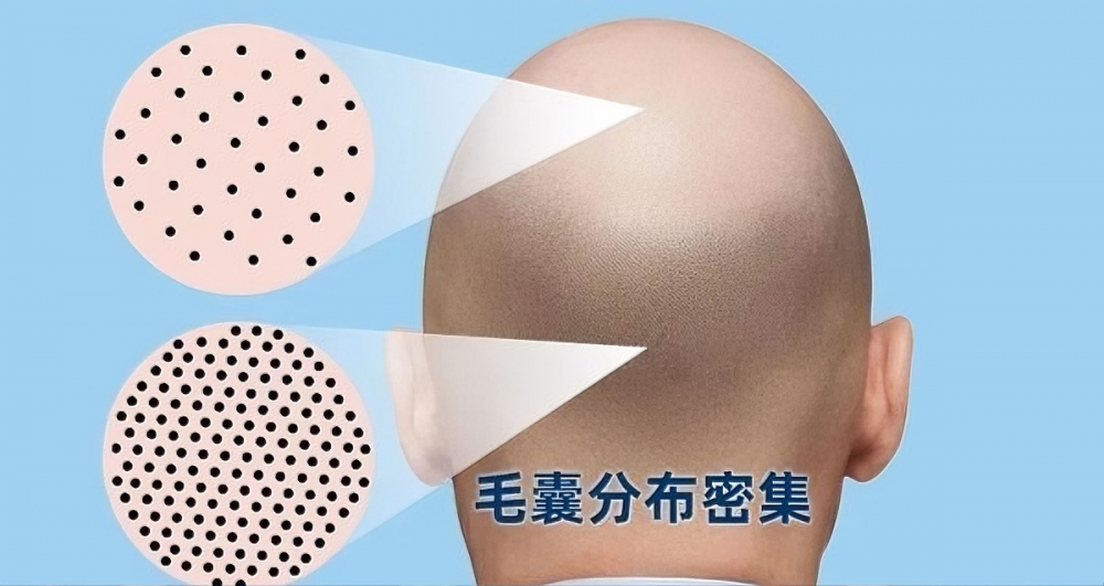 毛囊