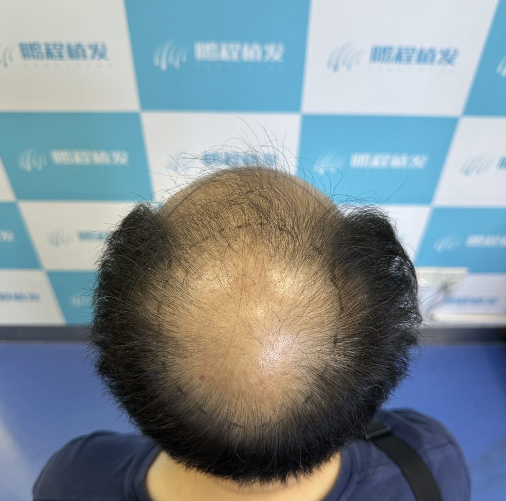 香港30歲被叫「大叔」？問題出係度