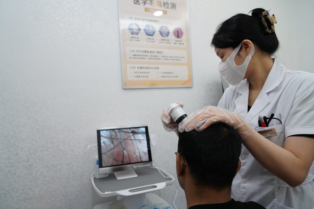 香港植髮前必看！手術全流程+術前術後注意事項，植髮新手唔使慌