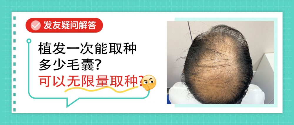 香港植髮一次可取多少毛囊？能否無限提取？專業拆解