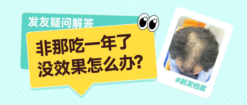 非那雄胺食一年無效果？拆解脫髮無改善原因｜香港髪友適用方案